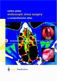 Endoscopic Sinus Surgery: A Comprehensive Atlas 