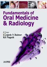 Fundamentals of Oral Medicine and Radiology 