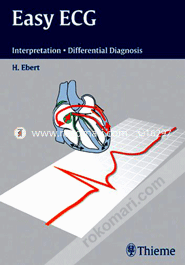 Easy ECG: Interpretation - Differential Diagnosis (Spiral)