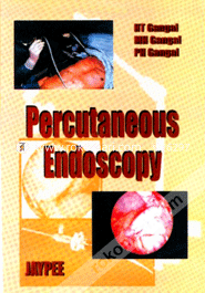 Percutaneous Endoscopy 