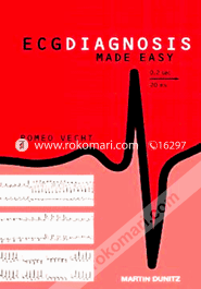 ECG Diagnosis Made Easy (Paperback)