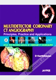 Multidetector Coronary CT Angiography 