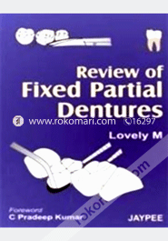 Review of Fixed Partial Dentures (Paperback)