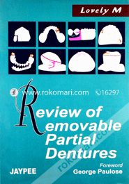 Review of Removable Partial Dentures (Paperback)