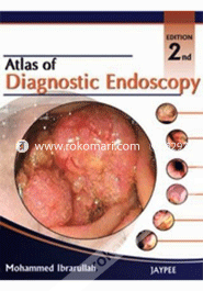 Atlas of Diagnostic Endoscopy (Paperback)