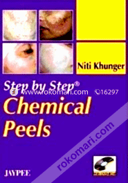 Step by Step Chemical Peels (with DVD Rom) (Paperback)