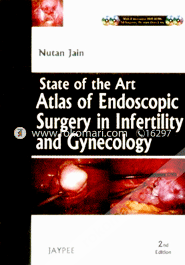 State of the Art: Atlas and Endoscopy Surgery in Infertility and Gynecology (with 4 DVD ROMs) 