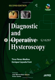 Diagnostic And Operative Hysteroscopy 