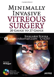 Minimally Invasive Vitreous Surgery: 20 Gauge to 27 Gauge 