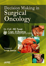 Decision Making In Surgical Oncology 