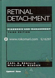 Retinal Detachment: Diagnosis and Management 