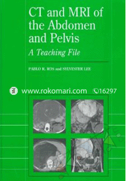CT and Mri of the Abdomen and Pelvis: A Teaching File