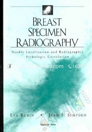 Breast Specimen Radiography: Needle Localization and Radiographic Pathologic Correlation 