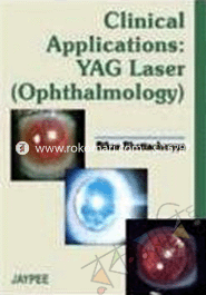 Clinical Application YAG Laser (Ophthalmology) 