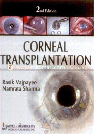 Corneal Transplantation 