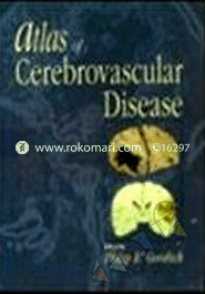 Atlas of Cerebrovascular Disease 