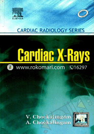 Cardiac X-Rays - Cardiac Radiology Series image