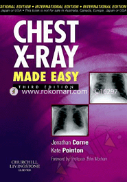 Chest X-Ray Made Easy 