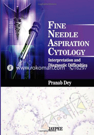 Fine Needle Aspiration Cytology: Interpretation and Diagnostic Difficulties image
