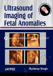 Ultrasound Imaging of Fetal Anomalies 