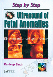 Step by Step Ultrasound of Fetal Anomalies 