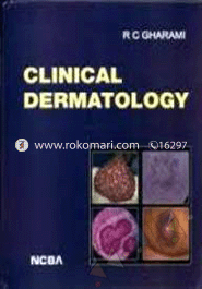 Clinical Dermatology 