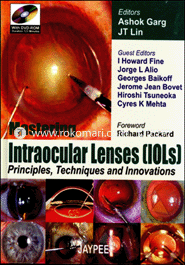 Mastering Intraocular Lenses (Iols) 