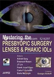 Mastering The Presbyopic Surgery Lenses and Phakik Iols With Dvd Rom 