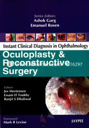 Instant Clinical Diagnosis In Ophthalmology, Oculoplasty 
