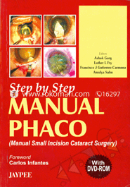 Step By Step Manual Phaco 