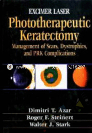 Excimer Laser Phototherapeutic Keratectomy: Phototherapeutic Keratectomy 