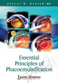 Essential Principles of Phacoemulsification 