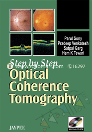 Step By Step Optical Coherence Tomography 