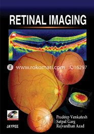 Retinal Imaging 