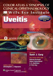 Color Atlas and Synopsis of Clinical Ophthalmology Uveitis 