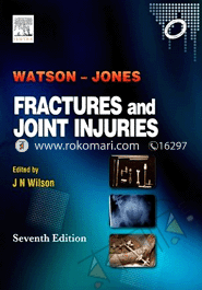 Watson-Jones Fractures and Joint Injuries 