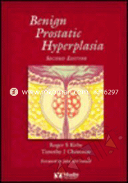 Benign Prostatic Hyperplasia 