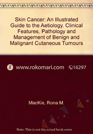 Skin Cancer: An Illustrated Guide To The Aetiology, Clinical Features, Pathology And Management Of Benign And Malignant Cutaneous Tumours 