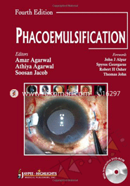 Phacoemulsification 