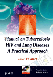 Manual on Tuberculosis HIV and Lung Diseases: A Practical Approach 