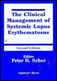 The Clinical Management Of Systemic Lupus Erythematosus 