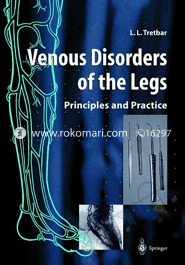 Venous Disorders of the Legs : Principles and Practice 