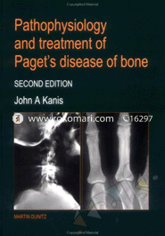 Pathophysiology and Treatment of Paget's Disease of Bone 