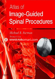 Atlas of Image Guided Spinal Procedures (Hardcover)