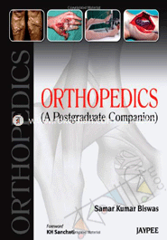Orthopedics: A Postgraduate Companion 