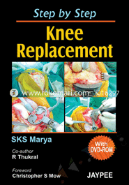 Step by Step Knee Replacement (With DVD-ROM) 