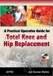 A Practical Operative Guide for Total Knee and Hip Replacement (With DVD Rom) 