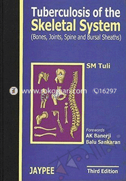 Tuberculosis of the Skeletal System 