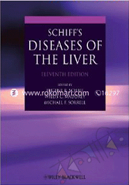 Schiff Diseases Of The Liver 
