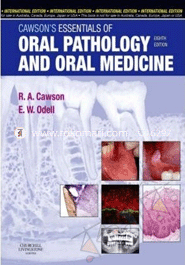 Cawson's Essentials of Oral Pathology 